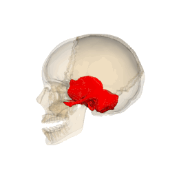 La UOSD di Chirurgia Protesica dell’AORN Santobono-Pausilipon attraverso l’ingegneria 3D ricostruisce l’osso temporale di una piccola paziente ipoacusica.