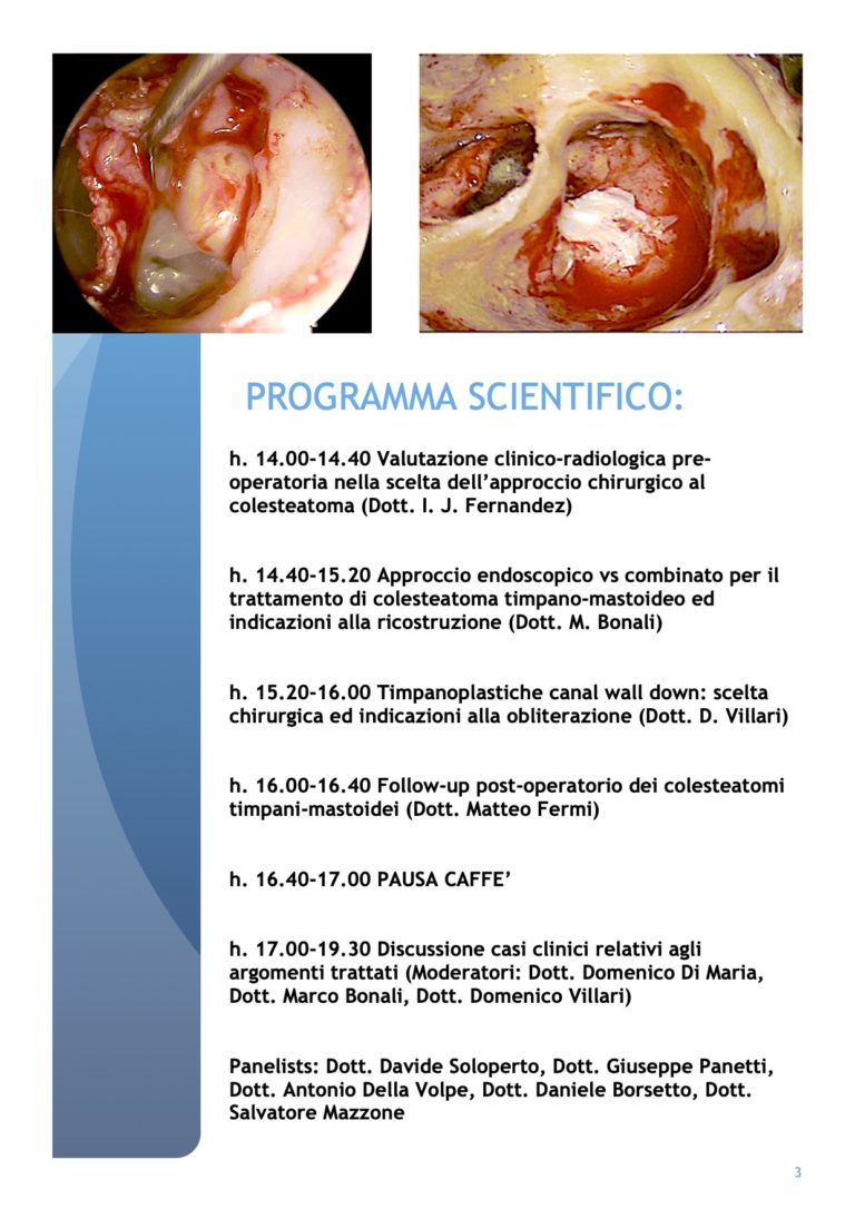 Webinar sul managment del colesteatoma